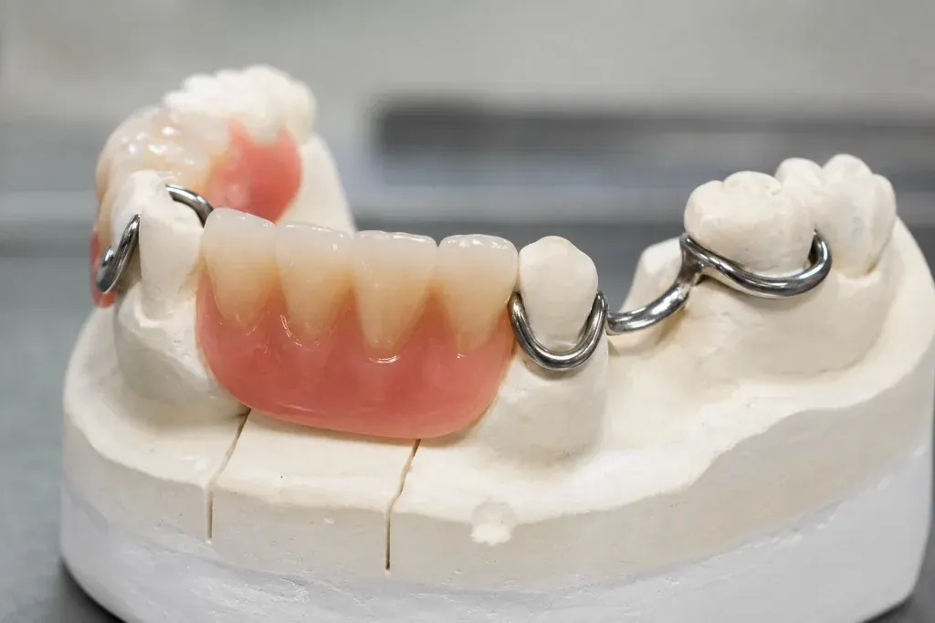 Semi Fixed Removable Overdentures Ahmedabad